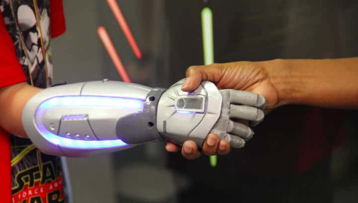 open bionics 1