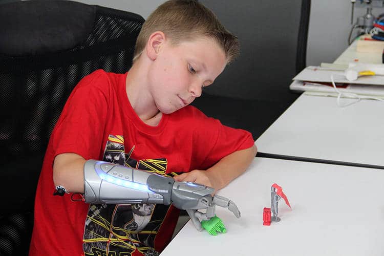 open bionics La prothèse de bras devient un acopen bionics 5cessoire de super-héro