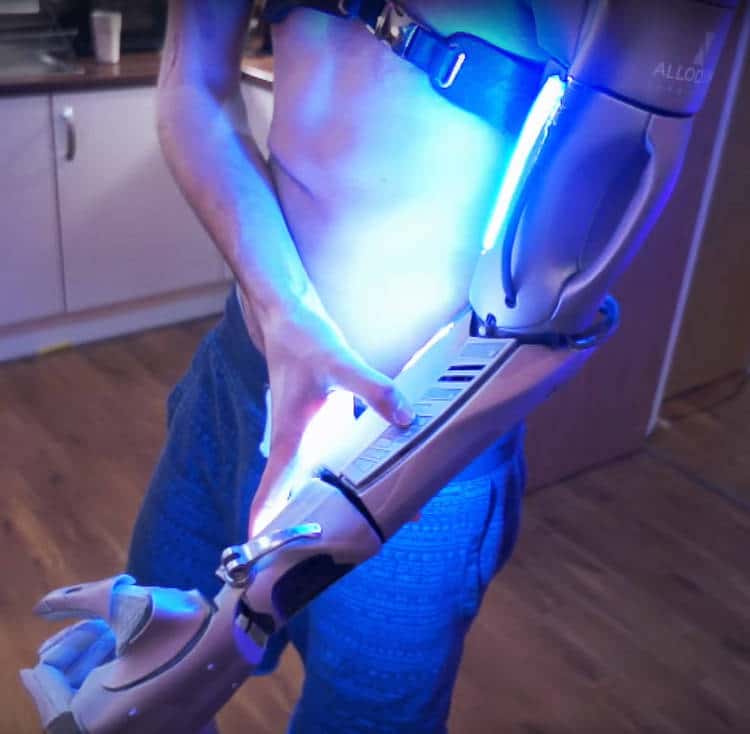 Une prothèse techno futuriste directement reliée à l’os